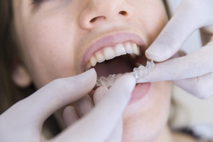 ortodoncia invisalign adultos