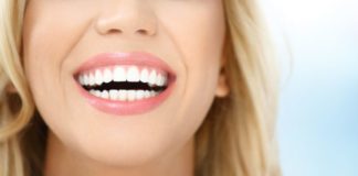 Sonrisa implante dental